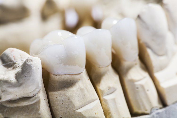 Velvet Dental - Clinica stomatologica, Bucuresti